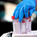 At 550,000 coronavirus tests daily in the USA, testing still far below level for safe reopening