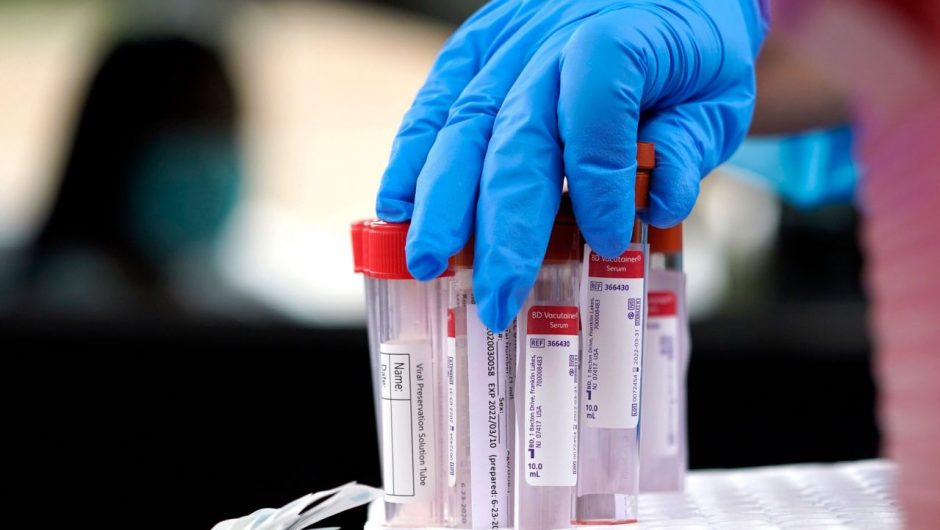 At 550,000 coronavirus tests daily in the USA, testing still far below level for safe reopening