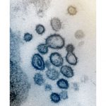 PNG demands China explain COVID-19 vaccine trial on miners