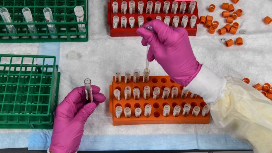 How to feel confident that a COVID-19 vaccine is safe