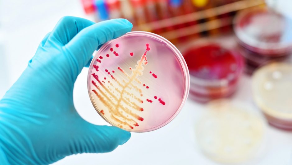 COVID-19 now blamed for rise in ‘super gonorrhea’