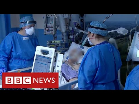 NHS leaders warn of intense pressure as Covid cases surge across UK – BBC News
