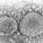 New variants raise worry about COVID-19 virus reinfections