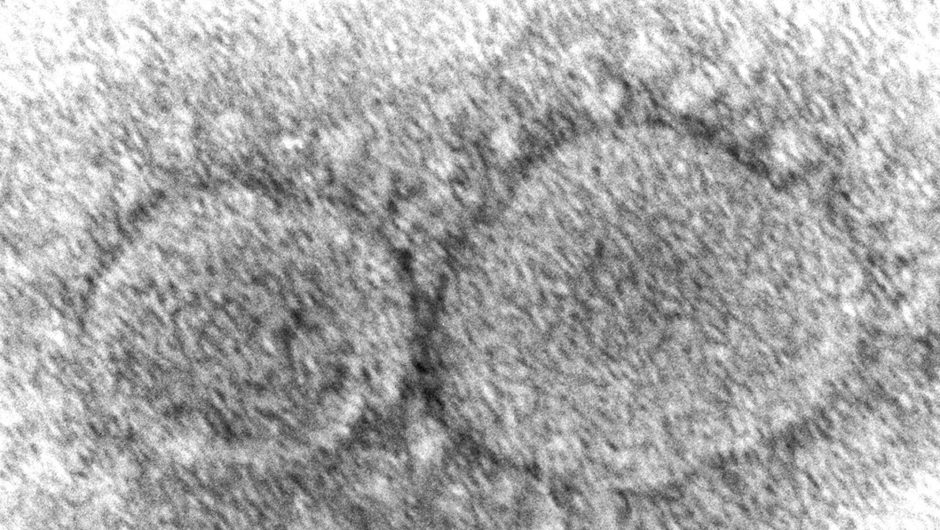 New variants raise worry about COVID-19 virus reinfections