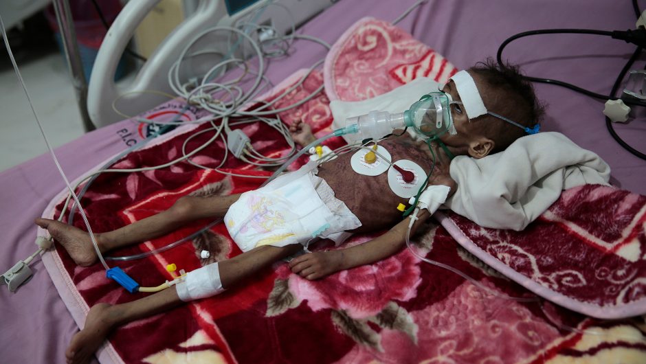 UN warns COVID-19 is ‘roaring back’ as Yemen faces famine