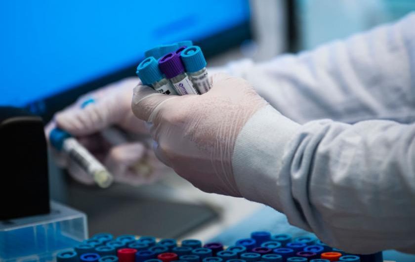 Researchers are racing to develop a test that shows how long COVID-19 vaccines work
