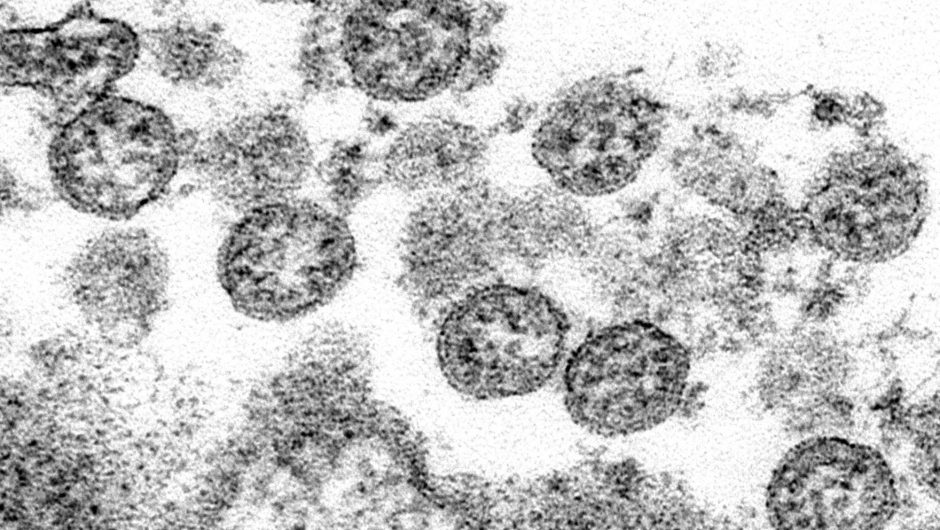 More evidence suggests COVID-19 was in US by Christmas 2019