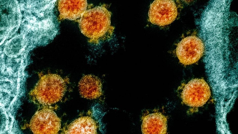 ‘Delta’ coronavirus variant first found in India reaches US. Here’s what to know