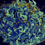 UN urges action to end AIDS, saying COVID-19 hurt progress
