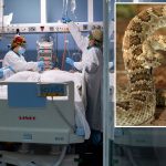 COVID-19 is like getting a rattlesnake bite: study