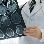 NYC man’s fatal brain disease linked to COVID-19: ‘Highly likely’