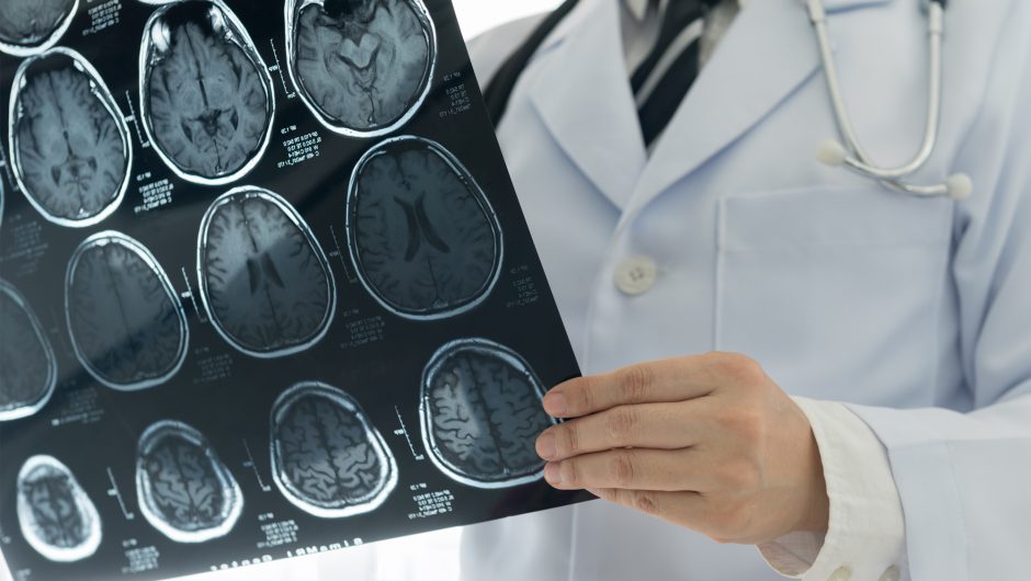 NYC man’s fatal brain disease linked to COVID-19: ‘Highly likely’