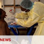 More mpox expected in Europe over the coming weeks, World Health Organization warns | BBC News