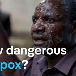 New mpox virus: Why is it spreading so quickly? | DW News
