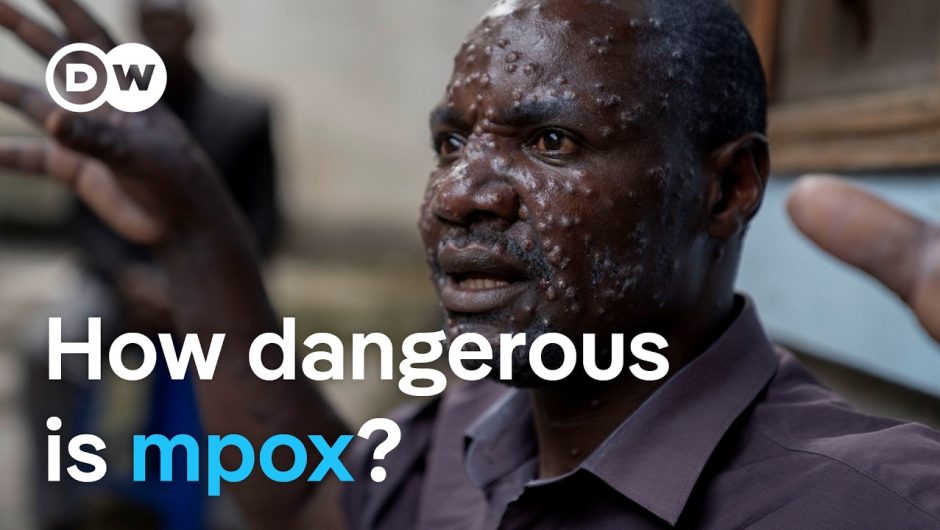 New mpox virus: Why is it spreading so quickly? | DW News